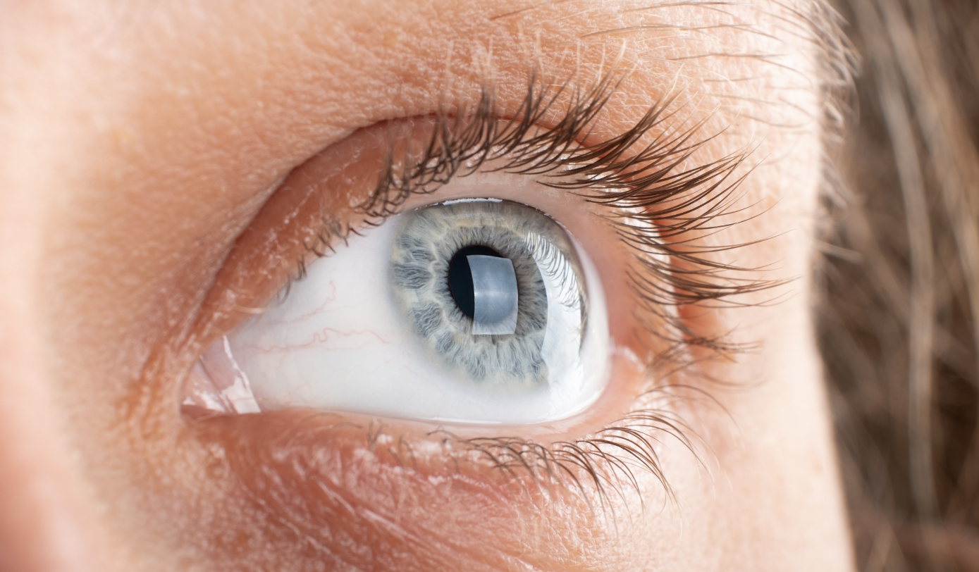 Cataract Surgery Service