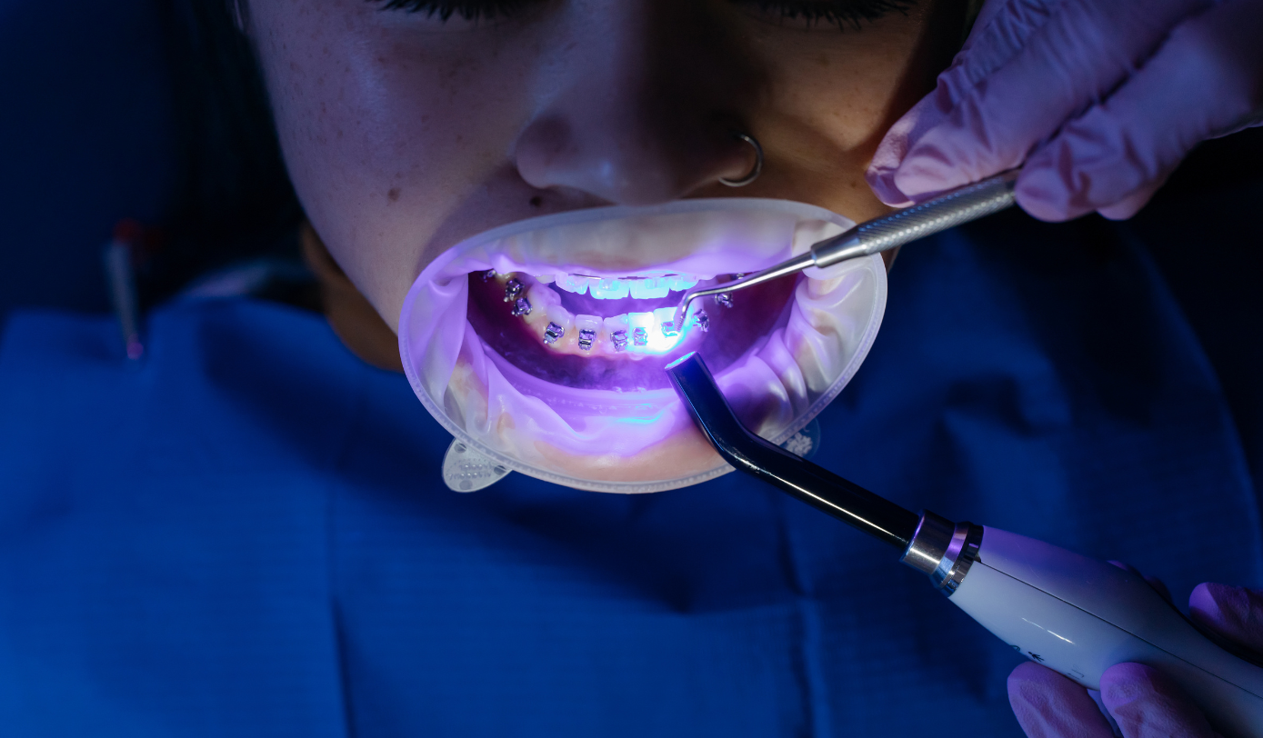 Teeth Treatment Service