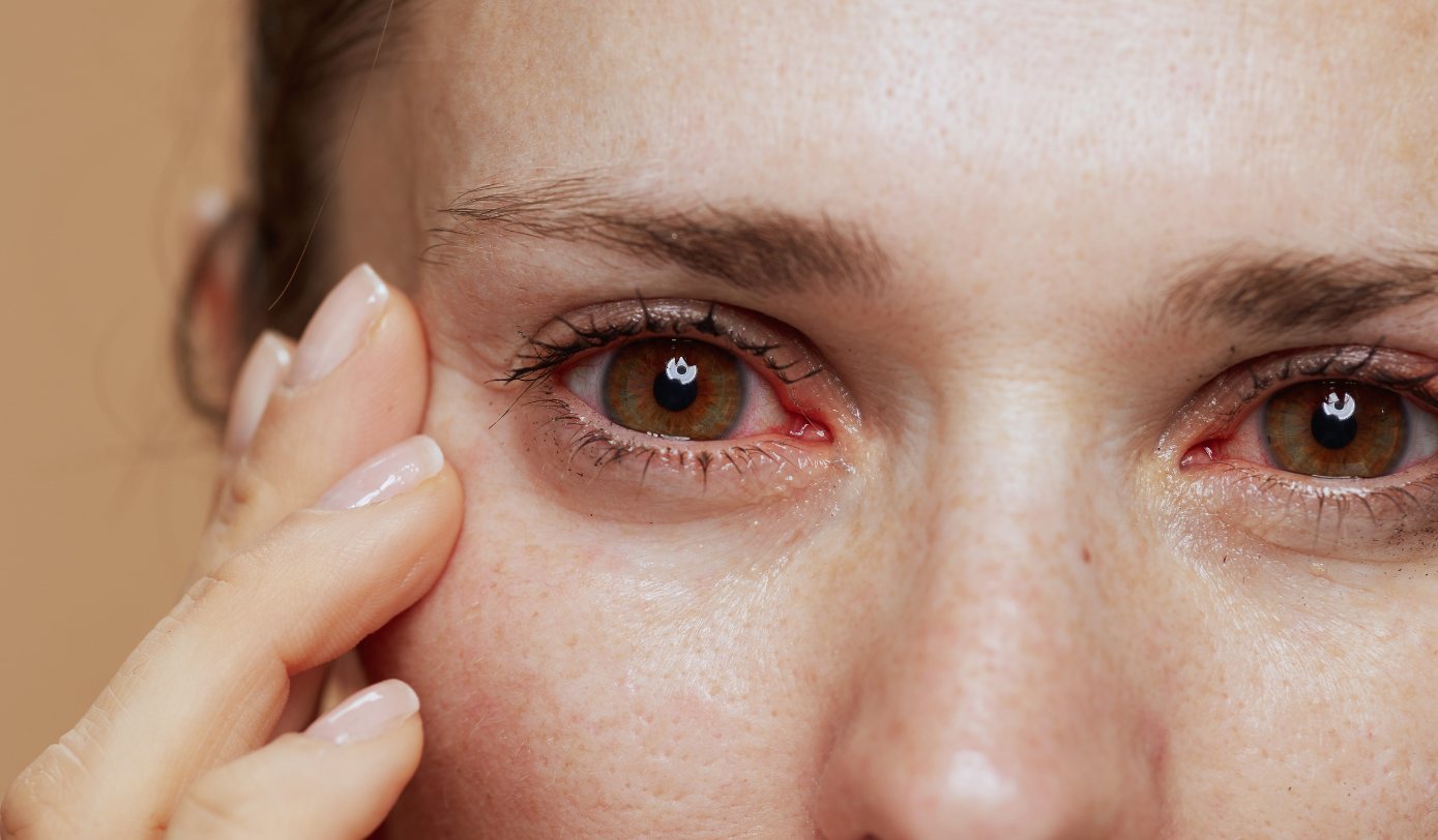 Vision Therapy Service